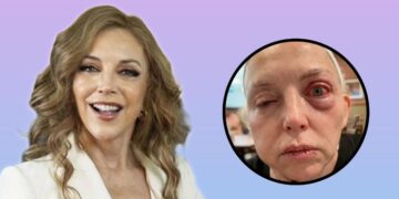 Laura Flores desmiente rumores de eutanasia en Instagram